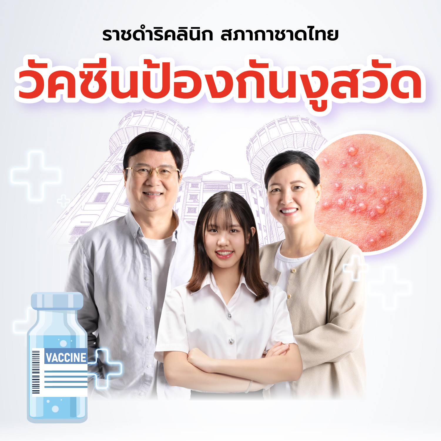https://uat-service.iredcross.org/uploads/herpeszoster/1773906629_a4067344411b678d471b.jpg